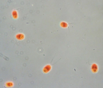 Dunaliella salina in Bio technology and specialty uses